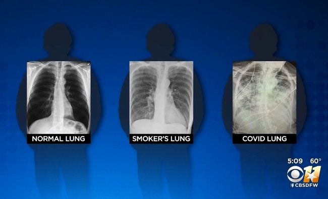 dfw.cbslocal.com 영상 캡쳐